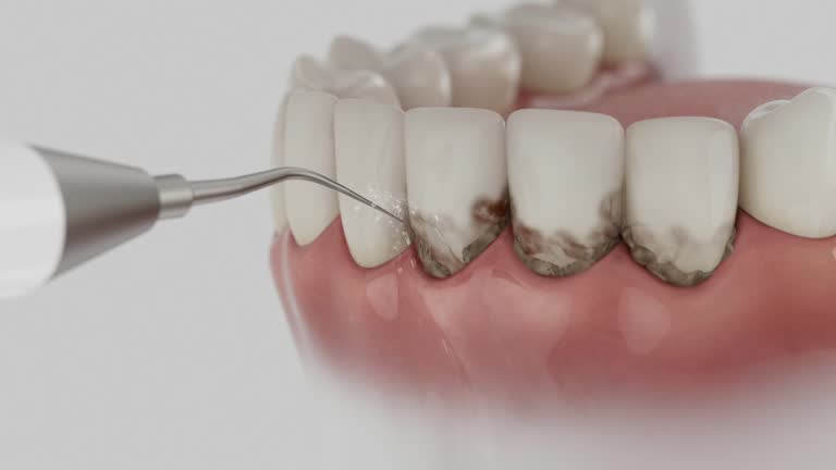 Reliable Dental contractor in Friday Harbor, WA by Dentist Open Now